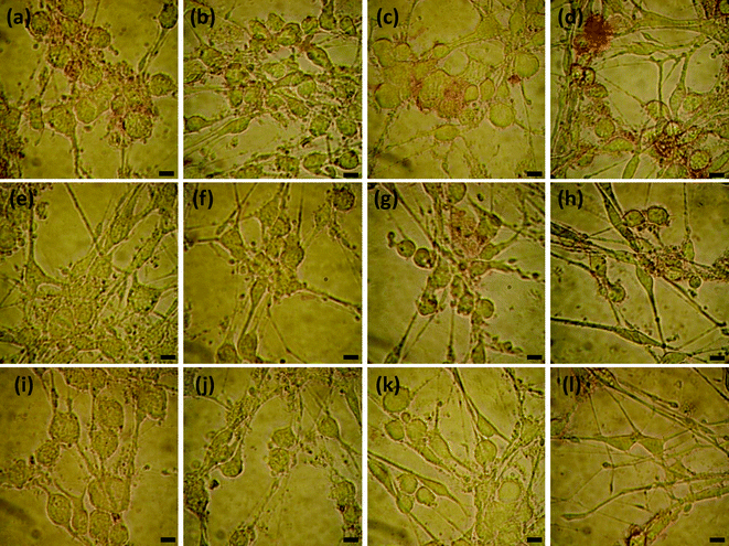 Effects of chelators on Cu2+ induced interaction of Aβ1–16(biotin) with SHG-44 cells (2.25 × 105 cells mL−1). The images represent: cells co-cultured with Aβ1–16(biotin), 5 μM Cu2+ and 0.5 (a), 5 (e), 50 (i) μM EDTA; 0.5 (b), 5 (f), 50 (j) μM EGTA; 2.5 (c), 25 (g), 250 (k) μM histidine; 0.5 (d), 5 (h), and 50 (l) μM clioquinol, respectively. The scale bars indicate 10 μm.