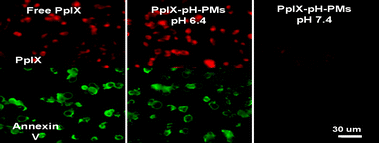 Cellular uptake and photocytotoxicity of free PpIX and PpIX-pH-PMs against SCC7 cells observed by confocal laser scanning microscope. Fluorescence images of PpIX were obtained with a TRITC filter set (red), Annexin V-FITC stain (green) depicts apoptotic cells.