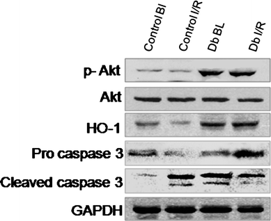 Western blot analysis of p-Akt, heme oxygenase protein HO-1, procaspase 3 and cleaved caspase 3 from the cytosolic fraction of control, ischemic and DB treated heart samples. GAPDH was used as the loading control. Figures are representative images of three different groups, and each experiment was repeated at least thrice.