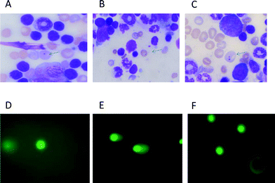 Photomicrographs showing mouse bone marrow erythrocytes stained with May–Gruenwald–Giemsa (A–C) and comets from heart cells stained with SYBR green-II. (D–F). A: micronucleus in polychromatic (immature) erythrocyte, bluish in colour. B: micronucleus in normochromatic (matured) erythrocytes, golden yellow in colour. C: polychromatic erythrocytes containing two micronuclei. D: comet in a normal cell. E: comet in a doxorubicin treated cell. F: comet in a cell of mice treated with Dox following squalene oral administration of 400 μl 1 h after Dox.