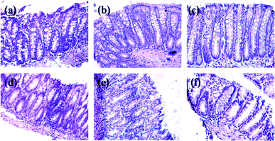 Distal colon tissue stained with hematoxylin and eosin. (a) Control; (b) CB; (c) NDF; (d) AOM; (e) CB + AOM; (f) NDF + AOM. Magnification ×20. The ACF (indicated by arrows) increased staining intensity of epithelial cytoplasm and presented irregular elongation of the ducts. Some ACF presented conical shape of the focus. CB: cooked bean; NDF: non-digestible fraction; AOM: azoxymethane.