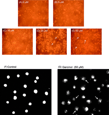Induction of chromatin condensation by garcinol in Hep 3B cells. (A–E) Induction of apoptotic bodies by garcinol. Hep3B cells were treated with 0 μM, 5 μM, 10 μM, 25 μM, 50 μM of garcinol for 24 h. The morphological changes of Hep3B cells were observed by light microscopy. 0 μM (vehicle). (F, G) Induction of chromatin condensation by garcinol. Hep3B cells were treated with 0.05% DMSO as vehicle control or 50 μM garcinol for 24 h, followed by acridine orange treatment. The nuclear staining was examined by fluorescence microscopy (200×). Arrowheads indicate nuclear condensation. These experiments were performed at least in triplicate; a representative result is presented.