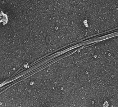 F-pili. Samples of E. coli strain DH1 containing the plasmid pTG801 were fixed in glutaraldehyde, quick frozen on a helium-cooled copper block, lyophilized, and platinum/carbon-shadowed before electron microscopy. The filaments are 8.5 nm in diameter. Photo courtesy of Robyn Roth and John Heuser.