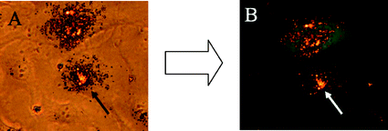 Transmission light microscopy (A) and fluorescence microscopy (B) of eGFP-transfected T24 cells. The DNA-carrying nanoparticles were labelled with red-fluorescing TRITC-BSA and can be seen on the nuclear membrane 48 h after transfection (arrow).