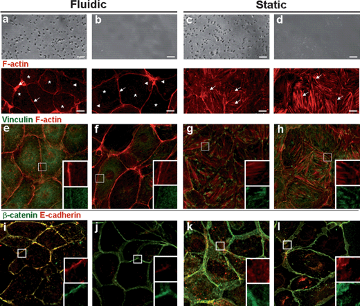 Reorganization of cytoskeleton, focal adhesions, and cell junction of IMCD cells under four different conditions: MMD (fluidic) (a, e, i), PDMS channel + glass substrate (fluidic) (b, f, j), transwell (static) (c, g, k), and glass substrate (static) (d, h, l). In fluidic condition, cells are subjected to 1 dyn/cm2 of fluid shear stress for 5 h. Optical (top panel) and confocal microscopy images of IMCD cells stained with antibodies for F-actin (red) (a–d, bottom, e–h), vinculin (green) (e–h), β-catenin (green) and E-cadherin (red) (i–l). The inset shows a magnified view of the boxed region (10 × 10 µm). Scale bar, 10 µm.