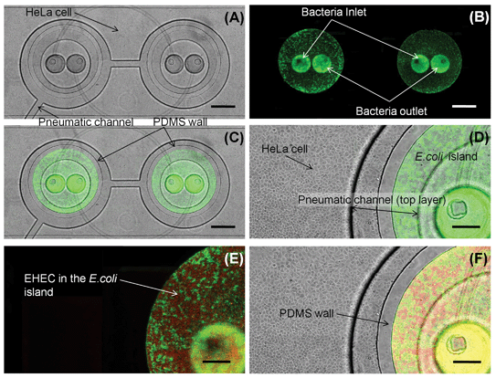 Co-culture of HeLa cells and bacteria. (A) Transmitted light image of HeLa cell monolayer. (B) Fluorescence image of GFP-expressing E. coli BW25113 localized in the bacterial islands. (C) Overlay of transmitted and green fluorescence images showing co-culture of HeLa cells and E. coli BW25113 for 48 h. (D) Close-up view of HeLa cells and E. coli BW25113 in bacterial-island after 48 h. (E) Fluorescence image of RFP-expressing EHEC and GFP-expressing E. coli BW25113 in island. (F) Overlay of transmitted, green, and red fluorescence images in the device. Scale bar represents 500 µm in panels (A)–(C) and 200 µm in panels (D)–(F).