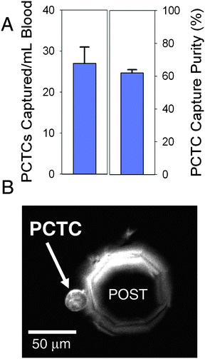 Peripheral whole blood samples taken from a patient with castrate-resistant prostate cancer were processed with GEDI μdevices. PCTCs were enumerated and the capture purity was calculated (A). Data is displayed as mean +/− SD, n = 4 aliquots of an individual patient sample. PCTCs were captured for 90% of patient samples analyzed (n = 20). A representative image is shown of a GEDI μdevice with a single PCTC captured on the wall of an octagonal post (B).
