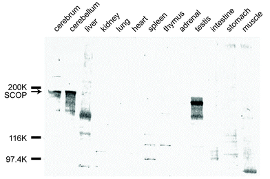 Immunoblot analysis of SCOP protein distribution. Protein extracts were prepared from various tissues of adult male rats. Marked immunoreactivity was observed only in the brain (cerebrum and cerebellum) and testes. Immunoreactivity of the testes migrated slightly faster than the predicted 183 kDa SCOP protein.