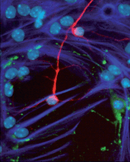 When transferred to differentiating conditions, NSC-derived neurospheres generate neurons (red), astrocytes (dark blue), and oligodendrocytes (green). Individual cells are identified by their DAPI+ve nuclei (light blue). © Dr Rodney Rietze, Pfizer Regenerative Medicine.