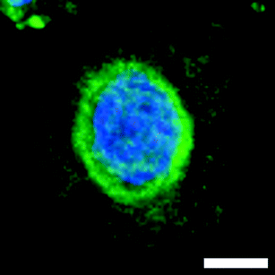 Redistribution of MTs around the nuclear envelope of HeLa cells treated with 25 at 100 nM, scale bar 5 μm.