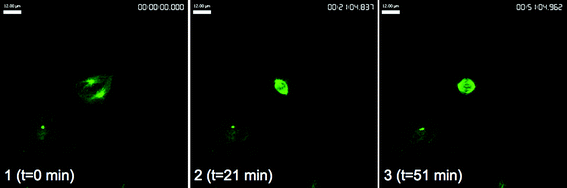 GFP-tubulin HeLa (cervical cancer) cells after treatment with control. Scale bar, 12 μm.