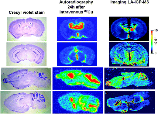 Shown are cresyl violet stained images (left panel) and digital autoradiographic phosphor images (middle panel) of adjacent sections of mouse brain 24 h after intravenous injection of 67Cu. The upper two panels show coronal slices. The lower two panels show sagittal images. The right panel shows similar brain regions in independent specimens analyzed by imaging laser ablation-inductively coupled plasma-mass spectroscopy (LA-ICP-MS). Images demonstrate a similar pattern of Cu uptake and distribution, with significantly greater Cu in the CSF spaces, and relatively lower Cu in the brain parenchyma.