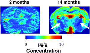 Coronal slices of brain in 2-month-old (left panel) and 14-month-old (right panel) mice imaged by laser ablation inductively coupled plasma mass spectrometry (LA-ICP-MS). Images demonstrate relatively homogeneous distribution of Cu in the brains of 2 month old mice. In 14 month old mice, there is a global increase in Cu content in the brain. White-matter regions as the capsula interna (arrows) show low Cu content in aging mice.