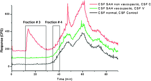 CSF Control, CSF C, CSF V capLC-ICPMS chromatograms. A peak at 12.1 min in the CSF C is being distinguished from CSF Control and CSF V. Also, a peak at around 38 min in the CSF Control and CSF C samples is not present in the samples from patients who have suffered SAH with vasospasm.