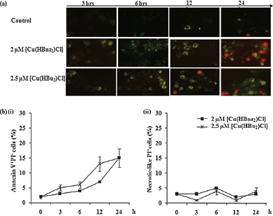 Assessment of apoptosis in MOLT-4 cells treated with Cu(ii) complexes. (a) Depiction of MOLT-4 cells exposed to [Cu(HBnz2)Cl] and [Cu(HBu2)Cl] over 24 h with annexin-V-FITC and propidium iodide staining. Cells were viewed under fluorescence microscopy using a 20× objective. (b) Flow cytometric assessment of apoptosis. MOLT-4 cells were treated with [Cu(HBnz2)Cl] and [Cu(HBu2)Cl] for 3, 6, 12, 24 h. Cell death was measured by labeling with annexin-V-FITC and counterstaining with propidium iodide. (i) apoptosis, (ii) necrosis-like cell death. Mean value ± standard deviation are shown. Cells stained with annexin-V-FITC only is characteristic for apoptosis (Fig. 3b(i)), while cells stained with PI alone is indicative of necrosis (Fig. 3b(ii)).25