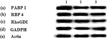 Western blot validation of the differentially expressed proteins in the compound treated MOLT-4 cells. Western blots of (a) PABP 1, (b) RBP 4, (c) RhoGDPi, (d) GADPH, (e) actin, 1: Untreated control, 2: [Cu(HBnz2)Cl], 3: [Cu(HBu2)Cl].