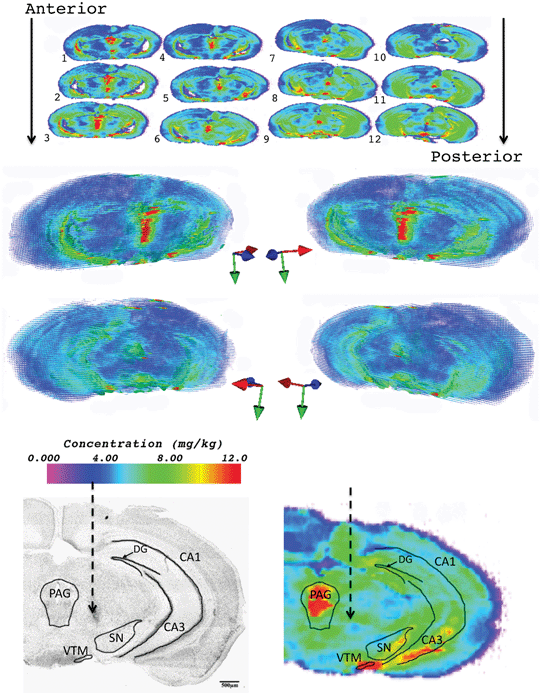 Two-dimensional images (top) and 3D reconstruction of Cu in 6-OHDA lesioned mouse brain (middle). Coloured arrows: Red = lateral, blue = anterior and green = ventral. Regions of mouse brain corresponding to increased trace element concentration are shown in a Nissl stain (bottom left) and 63Cu 2D image (bottom right) of section 6. SN = substantia nigra, DG = dentate gyrus, CA1 and CA3 fields of hippocampus, PAG = periaqueductal grey and VTM = ventral tuberomammillary nucleus.
