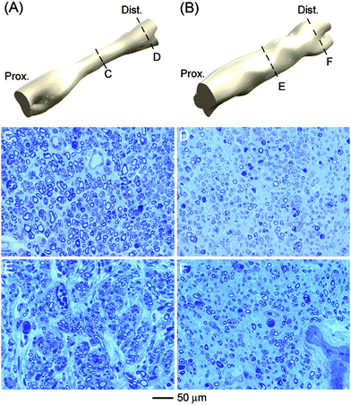 Isometric views of 3D reconstruction of regenerated nerve inside (A) silicone-, and (B) poly(ε-caprolactone)nanofiber-based nerve guidance conduits, respectively. Light microscopy images of cross sections of the regenerated nerve from middle (left side) and distal (right side) parts of the (C, D) silicone and (E, F) nanofiber-based conduits.