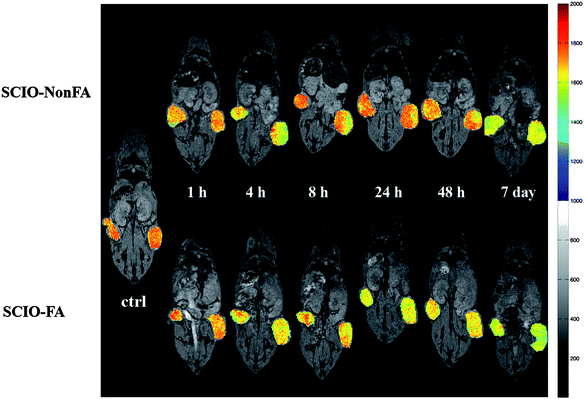 
          In vivo color maps of T2-weighted MR images of mice implanted with cancer cell line KB cells overexpressing FAR, at different time points after injection of SCIO-NonFA and SCIO-FA NPs, respectively. The color bar (from red to blue) indicates the MR signal intensity changes from high to low. Ref. 14; copyright Wiley-VCH Verlag GmbH & Co. KGaA. Reproduced with permission.