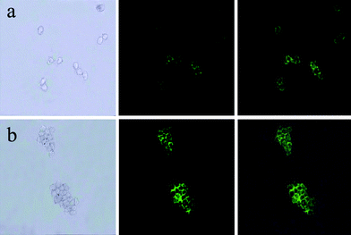 Images of live HeLa cells after being incubated with Fe3O4/NaYF4 nanocomposites biolabeled with transferrin incubated (a) for 1 h and (b) for 6 h. In the three panels, the left rows are images in bright field, the central rows represent fluorescent images in dark field and the right rows are the overlays of the left and central rows.