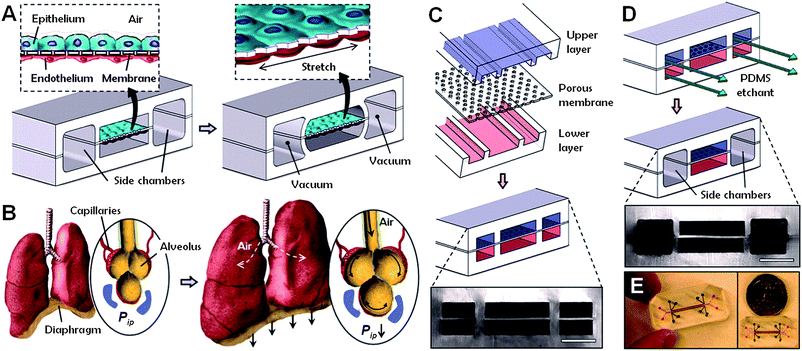 Lung-on-a-chip device. (A) The microfabricated device uses compartmentalized poly(dimethylsiloxane) (PDMS) microchannels to form an alveolar-capillary barrier on a thin, porous, flexible PDMS membrane coated with extracellular matrix (ECM) components. (B) During inhalation in the living lung, contraction of the diaphragm causes a reduction in intrapleural pressure (Pip), leading to distension of the alveoli and physical stretching of the alveolar-capillary interface. (C) Three PDMS layers are aligned and irreversibly bonded to form two sets of three parallel microchannels separated by a 10 μm thick PDMS membrane containing an array of through-holes with an effective diameter of 10 μm. (D) After permanent bonding, PDMS etchant is flowed through the side channels. Selective etching of the membrane layers in these channels produces two large side chambers to which vacuum is applied to cause mechanical stretching (i.e. ‘breathing’ lung mimic device). (E) Images of a lung-on-a-chip microfluidic device viewed from above. From: Huh D. et al. Reconstituting organ-level lung functions on a chip. Science, 2010, volume 328, pp. 1662–1668. Reprinted with permission from AAAS.