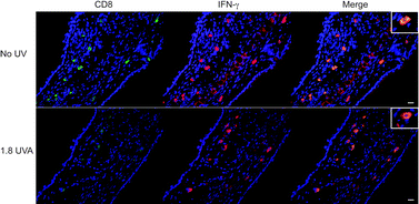 Skin-infiltrating CD8 T cells do not have inhibited IFN-γ production in 1.8 J cm−2 UVA-irradiated mice. Mice were exposed to 1.8 J cm−2 UVA, sensitised and challenged with oxazolone. Forty-eight hours after elicitation, the ear skin was assessed for CD8 (green) and IFN-γ (red). All CD8+ cells were found in the dermis and were co-localised with IFN-γ (orange, merge) in both unirradiated (no UV) and 1.8 J cm−2 UVA treated mice (1.8 UVA). The scale bar indicates 20μm. The inserts show higher magnifications of single CD8+IFN-γ+ cells.