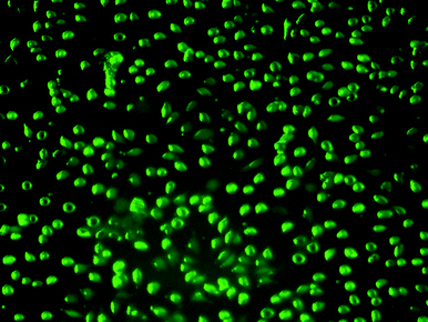 
            Fluorescence images of L929 cells incubated with micelles POEGMA93-block-P(STY56-co-TMI167) at 37 °C for 48 h.