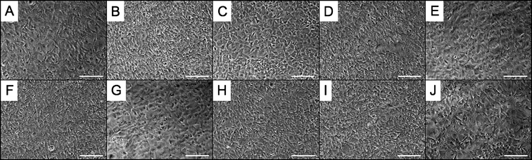 Elastomer extract-based in vitro cytotoxicity of PErD with fibroblasts. SA fibroblasts were cultured on tissue culture plastic in the presence of extracts from elastomer 4 (A), 5 (B), 6 (C), 11 (D), 12 (E), 13 (F), 14 (G), 15 (H), and 16 (I) for 48 h. As a positive control, cells were cultured in medium containing no polymer extracts (J). Fibroblasts were able to reach and maintain confluence, allowing these polyesters to be deemed non-cytotoxic. All scale bars represent 200 μm.