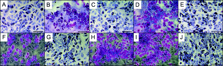 Elastomer extract-based in vitro cytotoxicity of PErD with stem cells. hMSCs were cultured on tissue culture plastic in the presence of extracts from elastomer 4 (A), 5 (B), 6 (C), 11 (D), 12 (E), 13 (F), 14 (G), 15 (H), and 16 (I) for 48 h. As a positive control, cells were cultured in medium containing no polymer extracts (J). After reaching confluence, induction medium was added to begin the differentiation process. As seen by the presence of vacuoles (red), hMSCs were able to differentiate into adipocytes after exposure to PErD extracts. All scale bars represent 200 μm.