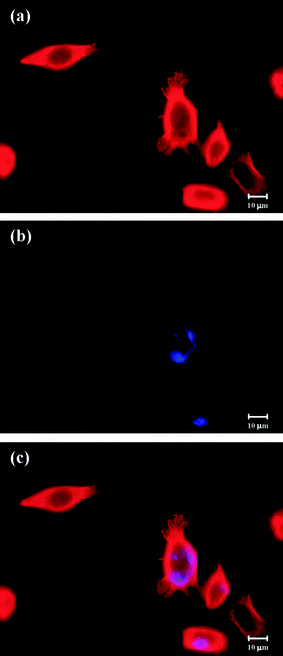 Colocalization of prodrug 16 and tubulin in NPC-TW01 cells under fluorescence microcopy139 (reprinted with permission from Y. S. Lin, R. Tungpradit, S. Sinchaikul, F. M. An, D. Z. Liu, S. Phutrakul and S. T. Chen, J. Med. Chem., 2008, 51, 7428, Copyright (2008) American Chemical Society).