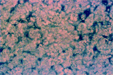 Photomicrograph of polymer IIb at 29 wt% CH3CN under cross polarizers exhibiting lyotropic LC phase (magnification 400×).