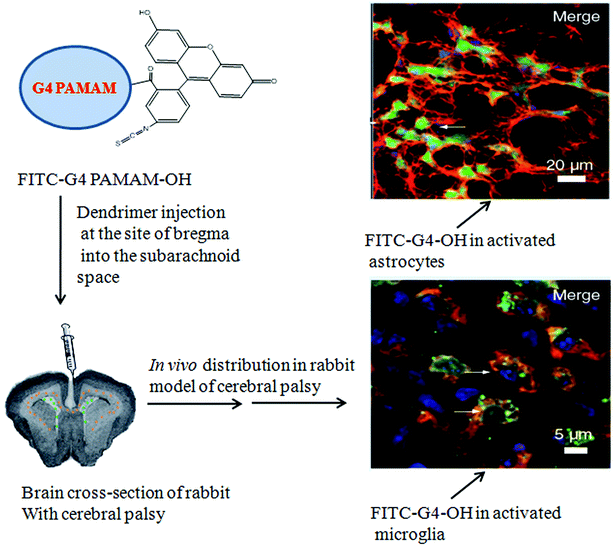 Selective uptake of G4 PAMAM–OH–FITC dendrimer in activated microglia and astrocytes following subarachnoid injection in the cerebral palsy of rabbit model. Adapted from ref. 212.