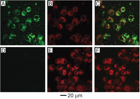 (A–C) U87MGwtEGFR cells after incubation with gold nanocages functionalized with EGFR antibodies. (D–F) Cells after incubation with non-targeted gold nanocages (functionalized with mPEG). (A, D) Two-photon images of gold nanocages showing little uptake without targeting. (B, E) Fluorescence images of SK-BR-3 cells with FM4-64 dye used to stain the membranes and endosomes. (C, F) Overlay of images of nanocages and images of cells, showing clear overlap between the two for the targeted nanocages. Modified with permission from ref. 24, copyright 2010 American Chemical Society.
