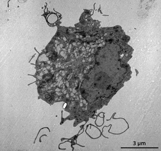 Transmission electron microscopy (TEM) image of a dendritic cell stretching out its dendritic to capture a hollow microparticle.