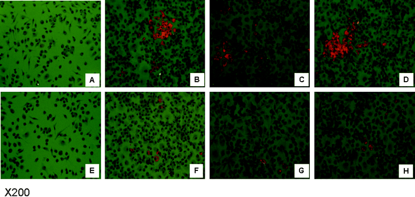 BB attenuated oxLDL induced foam cell formation. OxLDL was added to the culture media of peritoneal macrophages from apoE−/− mice fed BB or CD to induce foam cell formation. After 24 h incubation, foam cells were illustrated by the intensity of red spots after Oil-red O staining. Image A and E represent peritoneal macrophages from apoE−/− mice fed CD or BB before oxLDL incubation. Images B to D are peritoneal macrophages from apoE−/− mice fed CD after oxLDL incubation. Images F to H are peritoneal macrophages from apoE−/− mice fed BB after oxLDL incubation.