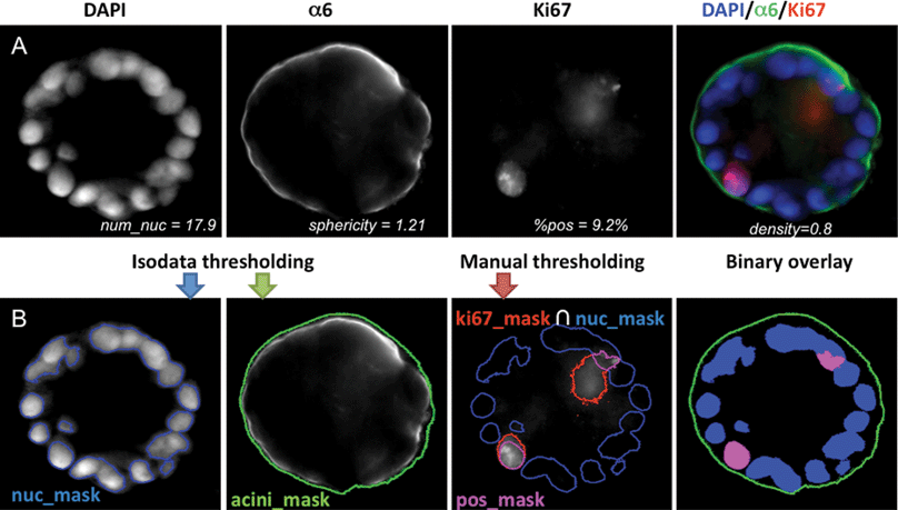 
            Quantification of acinar properties. (A) Center slice of a 12 day MCF10A acinus grown on top of Matrigel™ is shown: DAPI for nuclear staining (blue), α6 for basement membrane staining (green) and Ki67 for proliferation marks (red). Merged image is also shown as a color image in the right panel. Values for various imaging properties are displayed for this acinus. (B) Illustration of image analysis. An overlay of the masks for the nuclei (blue mask), for the basement membrane (green contour), and for the proliferating nuclei (purple mask) are shown below each corresponding channel. An overlay of all three binary masks with their corresponding colors is shown in the right panel.