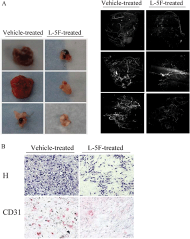 L-5F inhibits tumor angiogenesis in vivo. Flank tumors were established in wild-type C57BL6/J mice as described under Materials and Methods. After treatment with ABCT buffer or L-5F (10 mg kg−1, s.c., daily injection) for 5 weeks, mice were perfused with PBS to remove blood, and then the vasculatures were filled with MICROFIL. Dissected tumors were subjected to microCT scanning or IHC staining. A, microCT imaging analysis shows that L-5F decreases the quantity and size of vessels, compared to vehicle-treated group. Left, Dissected tumors from 3 mice that were vehicle treated and 3 mice that were L-5F treated. Right, the vessel images from the tumors shown on the left. B, IHC staining of tumor tissues. H, tissues were stained with hematoxylin to define tissue morphology. CD31, Immunostaining was performed with anti-CD31 for detection of endothelial cells in microvessels.