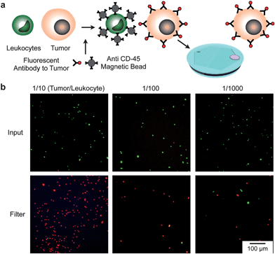 
          Detection of rare cells with the self-assembled magnetic filter. (a) A suspension of leukocytes (stained green) and tumor cells were incubated with a mixture of magnetic beads conjugated with anti-CD45 antibodies and fluorescent antibodies to the tumor (anti HER2/neu). The suspension was flown through the self-assembled magnetic filter and concentrated on an integrated micropore filter. (b) Fluorescence micrographs of the suspensions before passing through the filter and after concentrated on the micropore filter. The initial concentration of tumor cells to leukocytes was varied from 1/10 to 1/100 to 1/1000.