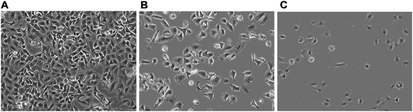 Viable A549 cells without treatment (A) and after treatment with 30 and 50 μM compound 1 (B and C, respectively).