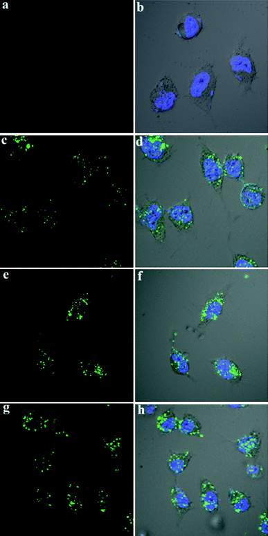 Confocal microscopy images of HeLa cells incubated with (a and b) Fl-siRNA; (c and d) Fl-siRNA and CNL 5a; (e and f) Fl-siRNA and CNL 5b; (g and h) Fl-siRNA and CNL 5c. Concentration of Fl-siRNA: 50 nM.