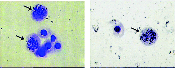 Typical mitotic cells. The arrow indicates the cells with metaphase chromosomes.