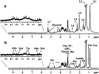 
              1H HR-MAS NMR spectra of a human liver biopsy sample (rotation rate 4 kHz): (a) standard 1H spectrum; (b) spin-echo (CPMG) spectrum. Assignments: L1–7 lipid resonances. Reprinted from ref. 55 with permission.