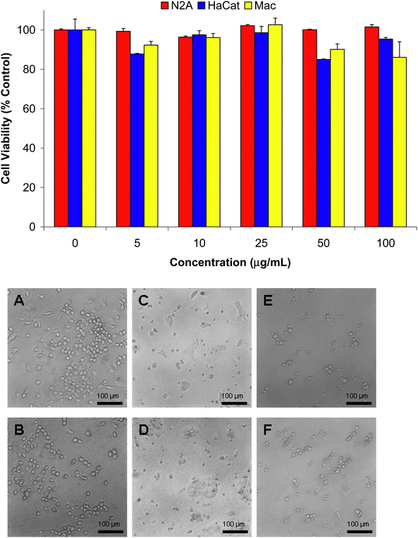 MTT viability assessement and morphological evaluation of N2A, HaCat, and macrophage cells after 24 h of incubation with 0–100 μg/mL of ND-T. Triplicate experiments show no significant difference in viability after exposure to ND-T compared to untreated controls. Phase contrast light microscopy of (A,C,E) Controls and (B,D,F) Cells incubated with 100 μg/mL ND-T. (A,B) N2A cells, (C,D) HaCat cells, and (E,F) Macrophages. There were no morphological changes compared to the controls.