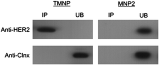 
          Immunoprecipitation of HER2 in MCF7 cells. Immuno-precipitation was performed using anti-HER2 or anti-calnexin antibodies cross-linked to TMNP and MNP2 (as negative control). Nanoparticles were incubated overnight at 4 °C in a whole extract of MCF7 cells. Bound (IP) and unbound (UB) proteins were eluted in SDS-PAGE application buffer, electrophoresed and immunoblotted.