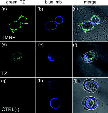 Confocal laser images of MCF7 cells cultured with TMNP or free TZ. MCF7 were incubated for 20 min with TMNP (100 µg mL−1; a–c) or TZ (11 µg mL−1; d–f). As negative control, MCF7 were stained with secondary antibodies anti-human FITC (g–i). Cell membranes (mb) were stained with DiD oil (blue). TMNP and TZ were labeled with anti-human FITC secondary antibodies. Scale bar = 10 µm.