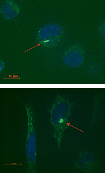 
          Confocal microscope images of Hela cells. Nuclei were stained with the fluorescent stain DAPI. MWNTs coated with the fluorescent copolymer can be visualized in the proximity of the nuclei (red arrows).