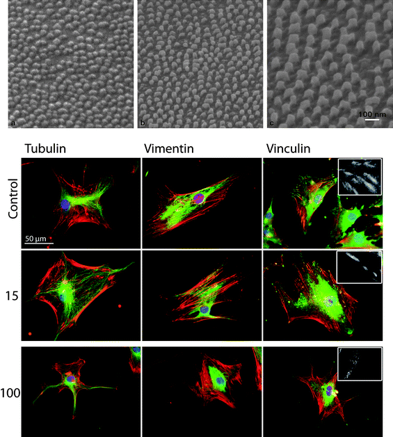 Side-view SEM images of Ti surfaces after anodization at three different voltages and chemical removal of the alumina masks (above). Cytoskeletal and focal adhesions (FA) staining in human skeletal mesenchymal stem cells (hMSCs) cultured on planar control and nanostructured Ti surfaces (below). Red, actin microfilaments; green, either tubulin microtubules; vimentin intermediate filaments or vinculin; blue, cell nucleus. Cells cultured on 15 nm high structured surfaces display a well-defined cytoskeleton and large FA sites, whereas on the higher structured surfaces (100 nm) cells have a less organized cytoskeleton and fewer, smaller FAs. Picture adapted from ref. 47. Copyright 2009, Elsevier.