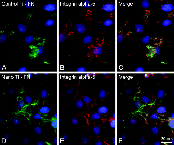 Epifluorescence of calvarial osteogenic cells grown on control (A–C) and nano Ti (chemically oxidated with H2SO4/H2O2) (D–F) at 3 days, labeled with anti-fibronectin (FN) (A,D, green fluorescence) and anti-integrin alfa 5 (B,E, red fluorescence) antibodies. (C,F) Merged pictures of A,B and D,E, respectively, indicating that integrin alfa 5 expression colocalizes with extracellular FN (yellowish). Integrin alfa-5 expression is up-regulated in osteogenic cells grown on nano Ti.50 Blue fluorescence indicates cell nuclei (DAPI DNA stain). Scale bar = 20 μm, (unpublished picture).