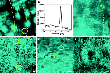 
            In vivo
            FWM images of SiNWs. (a) FWM image (red) of the peripheral blood of a living mouse taken at 20 min post injection of PEGylated SiNW PBS solution. Yellow dashed lines mark the blood vessel. The white solid line indicates the scan line for the intensity profile shown in (b). (b) FWM intensity profile from the line scan along the flowing SiNW. (c) FWM image of the peripheral blood of a living mouse taken post injection of PBS. (d–f) FWM images of SiNWs (red) deposited in the liver (d), spleen (e), and kidney (f) explanted at 1 h post injection. All FWM images are superimposed with transmission images (cyan) taken simultaneously. The SiNWs were highlighted by yellow circles. Scale bars, 5 μm. (Reprinted with permission from ref. 159, © 2009 American Chemical Society.)