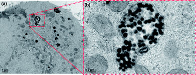 
            TEM images of KB cells incubated with the starting NBs (a) after 24 h at 37 °C. (b) Higher magnification of a portion of the same image showing an endosome containing a considerable amount of nanobeads, many nanostructures having an inner dark core corresponding to IONPs and a lighter polymer shell are well distinguishable within the endosome.